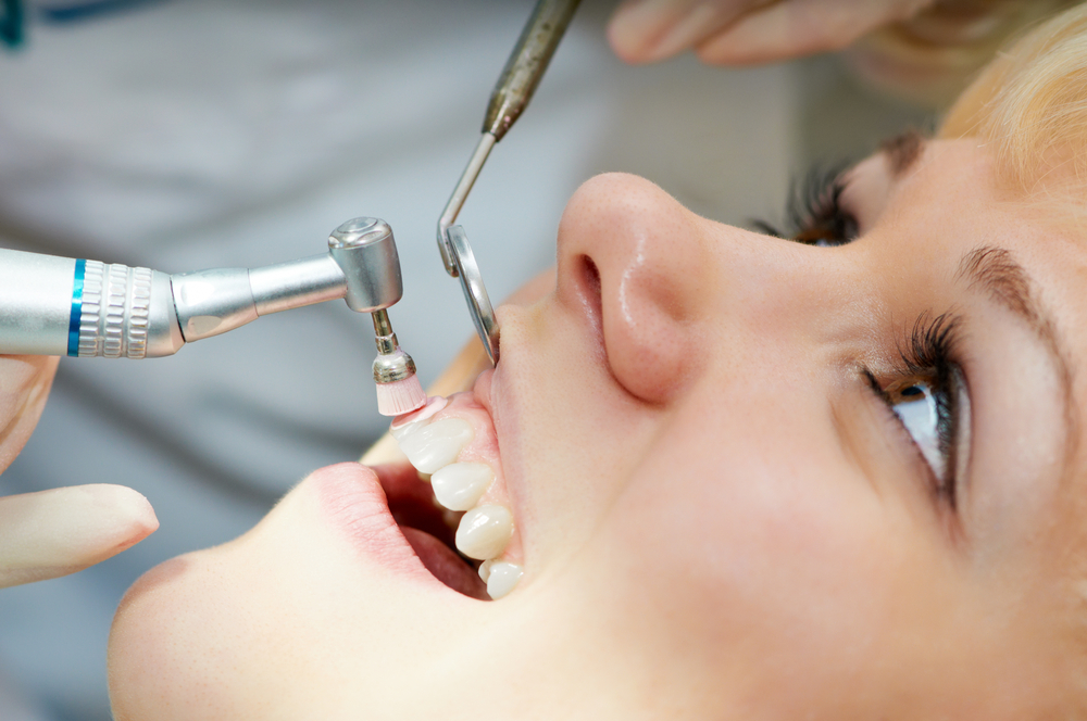 Cleaning and Preventions - Alameda Dental Care in Tempe, AZ