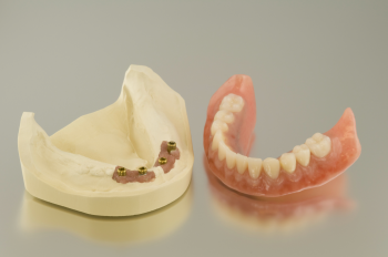 How to Clean Your Denture - Implant Supported Dentures