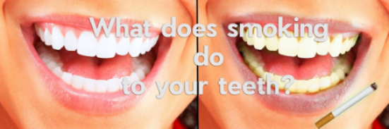 smoking affects your teeth